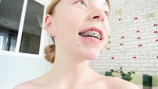 Watch deva_alice HD Porn Video [Chaturbate] - daddy, teen, lush, braces